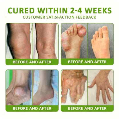 LOVILDS® Magnesium & Peppermint Arthritis Pain Relief and Bone Healing Cream