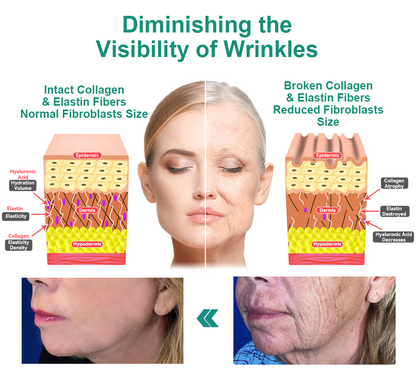 👨‍⚕️LOVILDS™ Luxury Firming Collagen Cream 🎄( 🔥50% off for a limited time!)