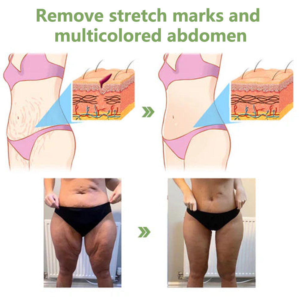 👨‍⚕️LOVILDS™ Luxury Firming Collagen Cream 🎄( 🔥50% off for a limited time!)