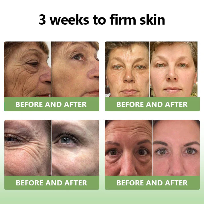 👨‍⚕️LOVILDS™ Luxury Firming Collagen Cream 🎄( 🔥50% off for a limited time!)