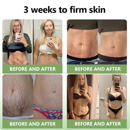 👨‍⚕️LOVILDS™ Luxury Firming Collagen Cream 🎄( 🔥50% off for a limited time!)