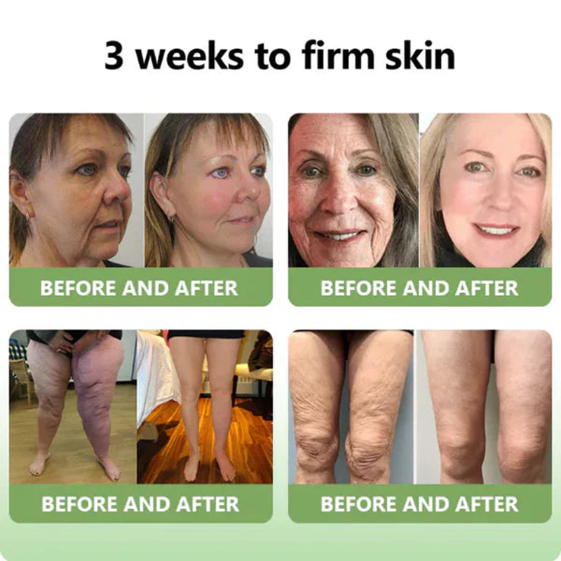 👨‍⚕️LOVILDS™ Luxury Firming Collagen Cream 🎄( 🔥50% off for a limited time!)