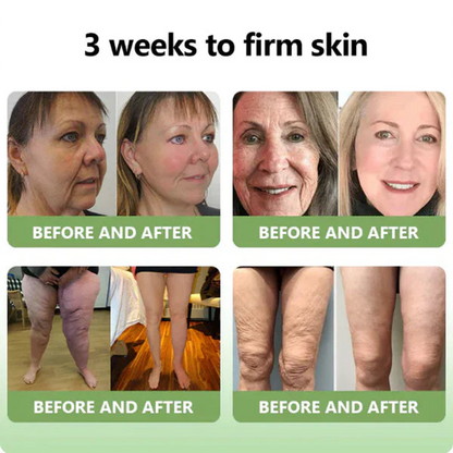 👨‍⚕️LOVILDS™ Luxury Firming Collagen Cream 🎄( 🔥50% off for a limited time!)