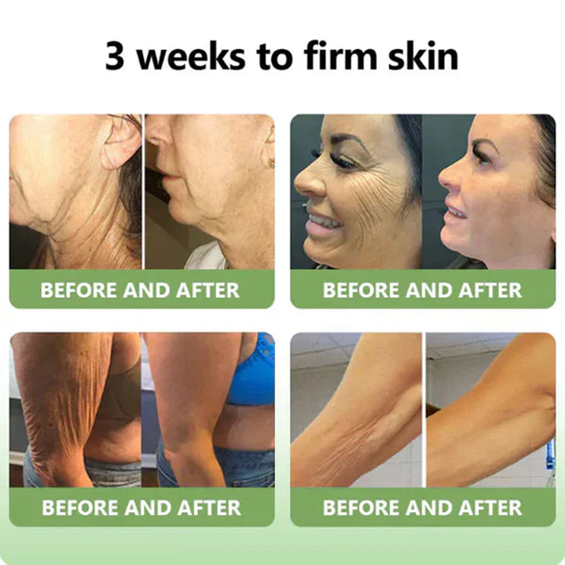 👨‍⚕️LOVILDS™ Luxury Firming Collagen Cream 🎄( 🔥50% off for a limited time!)