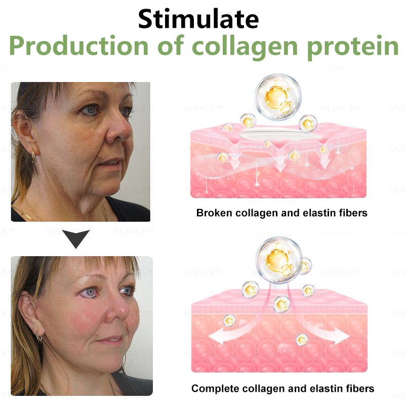 👨‍⚕️LOVILDS™ Luxury Firming Collagen Cream 🎄( 🔥50% off for a limited time!)