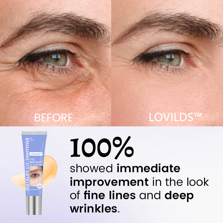 LOVILDS™ InstaLift Eye Tightener 🔥