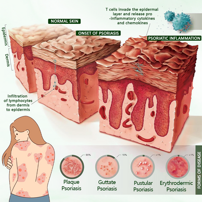 LOVILDS™  Tea Tree Healing Cream