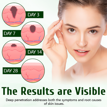 LOVILDS™  Tea Tree Healing Cream