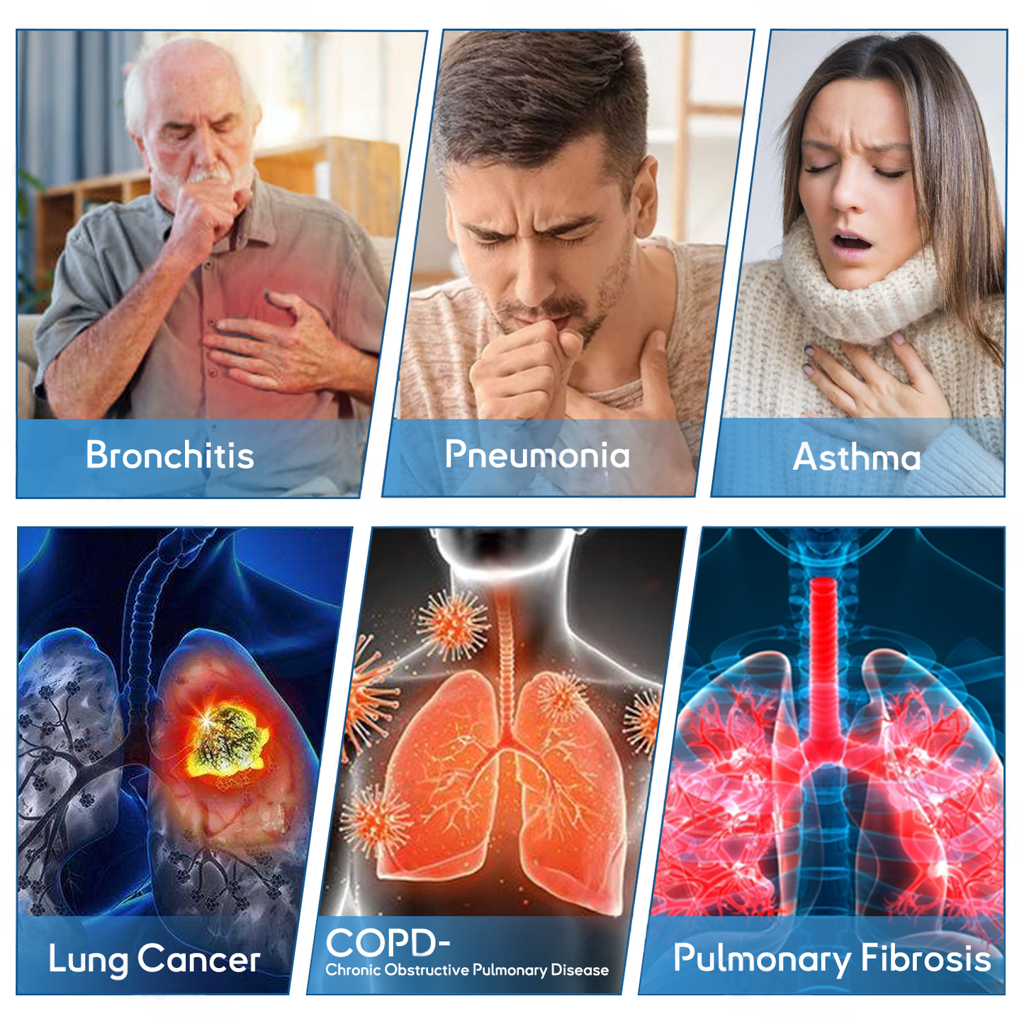 👑Official Store: Qooes™ DoubleNano Advanced Lung Detox Relief Patch