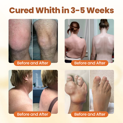 LOVILDS™ Premium Curcumin Pain Relief Gel