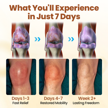 LOVILDS™ Premium Curcumin Pain Relief Gel